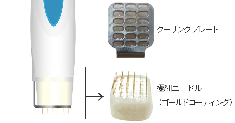 特許技術取得の冷却システムと絶縁針（カートリッジ）