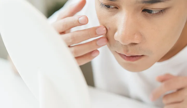 ほくろを気にする男性